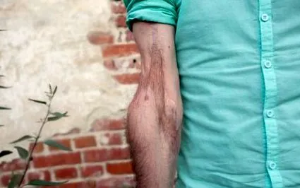 коса
