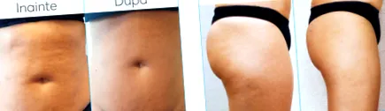 innovatív cryomed