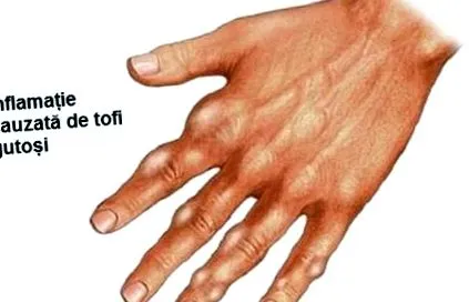 húgysavat