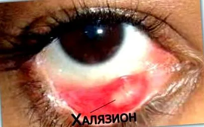 стомна