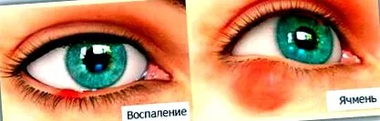 болести можат