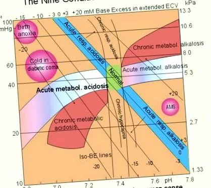 acidózis acidózis