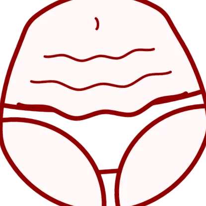 eltávolítás