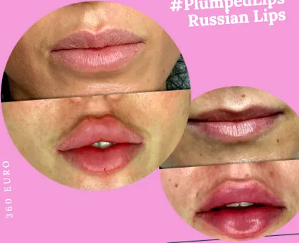 киселина