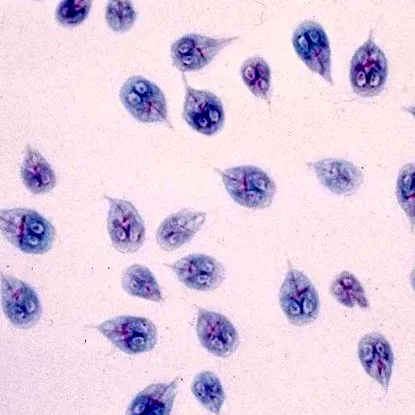giardia méregtelenítő