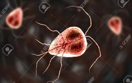 giardiasis