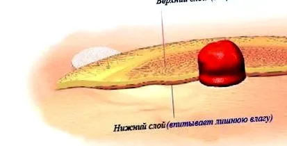 системот одводнување