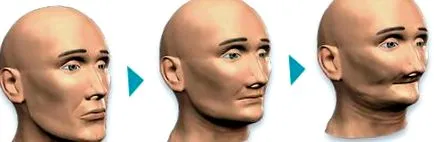 oltás