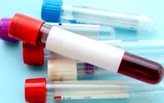hemochromatóza hemochromatóza