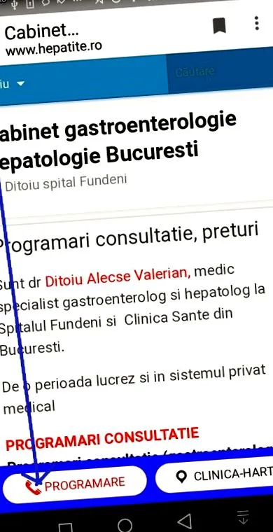 tüneteket ditoiu