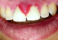 hormonok