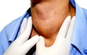 hyperthyreosis