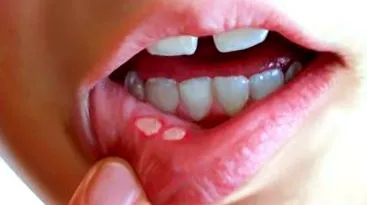 hormonok