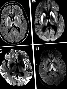 таблетки Enterobiosis Helix