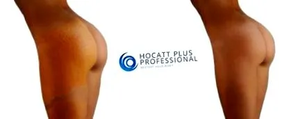 útmutatások hocatt