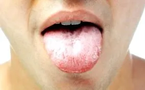 nyelv