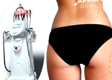 lipo lipo