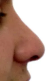eredményeiről