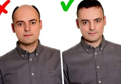 megtörténhet
