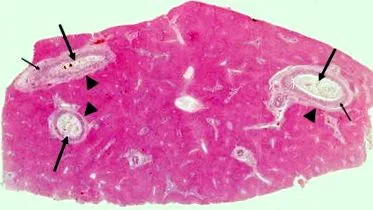 fasciolioza principal