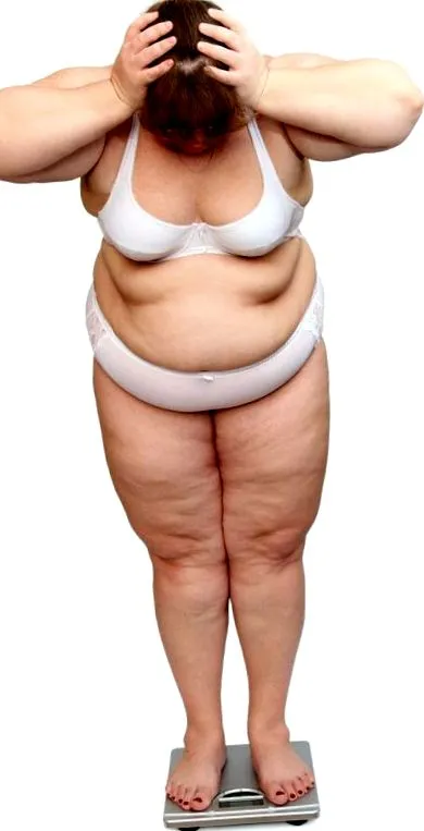obesitex