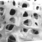 osteoporosis