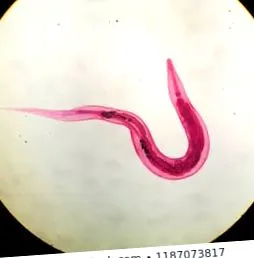 oxyurosis