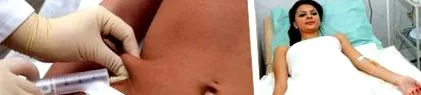 betegek