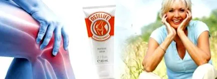 ostelife Ostelife ízületi