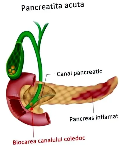 pankreasu