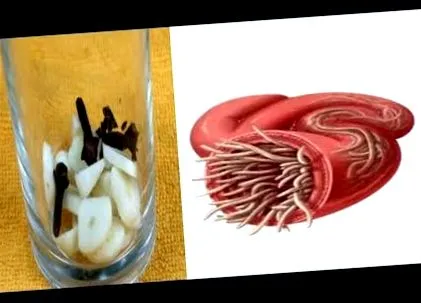 szoptatás