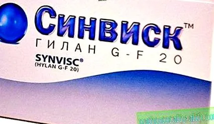 огляд суглобів
