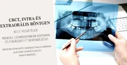cbct рентгенов