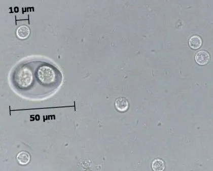 англійсько-угорська giardia