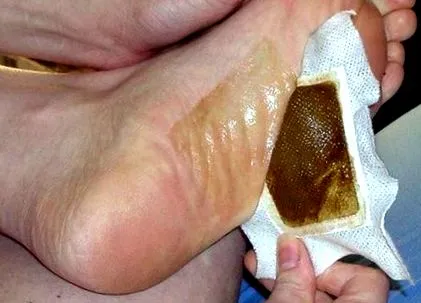 lábtapaszra lánc méregtelenítő