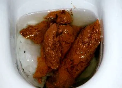 ditoiu