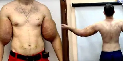 pokraji pokraji