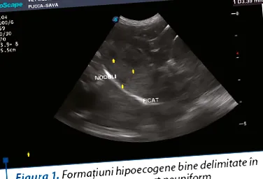duzzanat