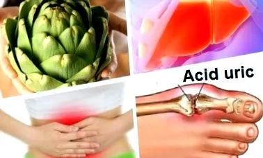 articsókával