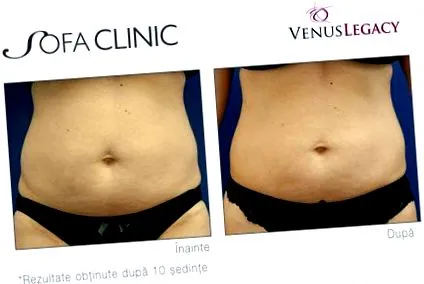 venus