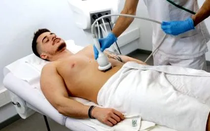 fogyás rádiófrekvenciával