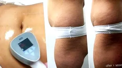 exilis-sel