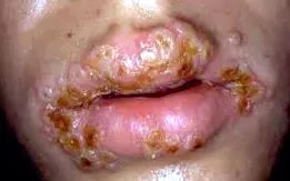 hepatológiai magánrendelés