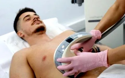 fogyás