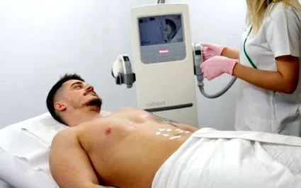 fogyás