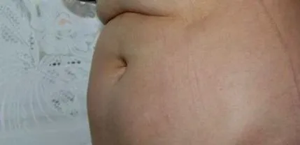 Slimmer Spray