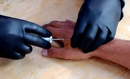 слабеење