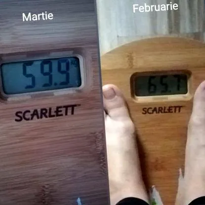 császármetszés császármetszés