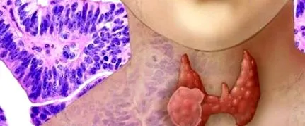 болница oncofort