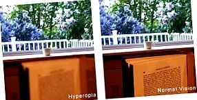 короткозорість далекозорість плюс мінус